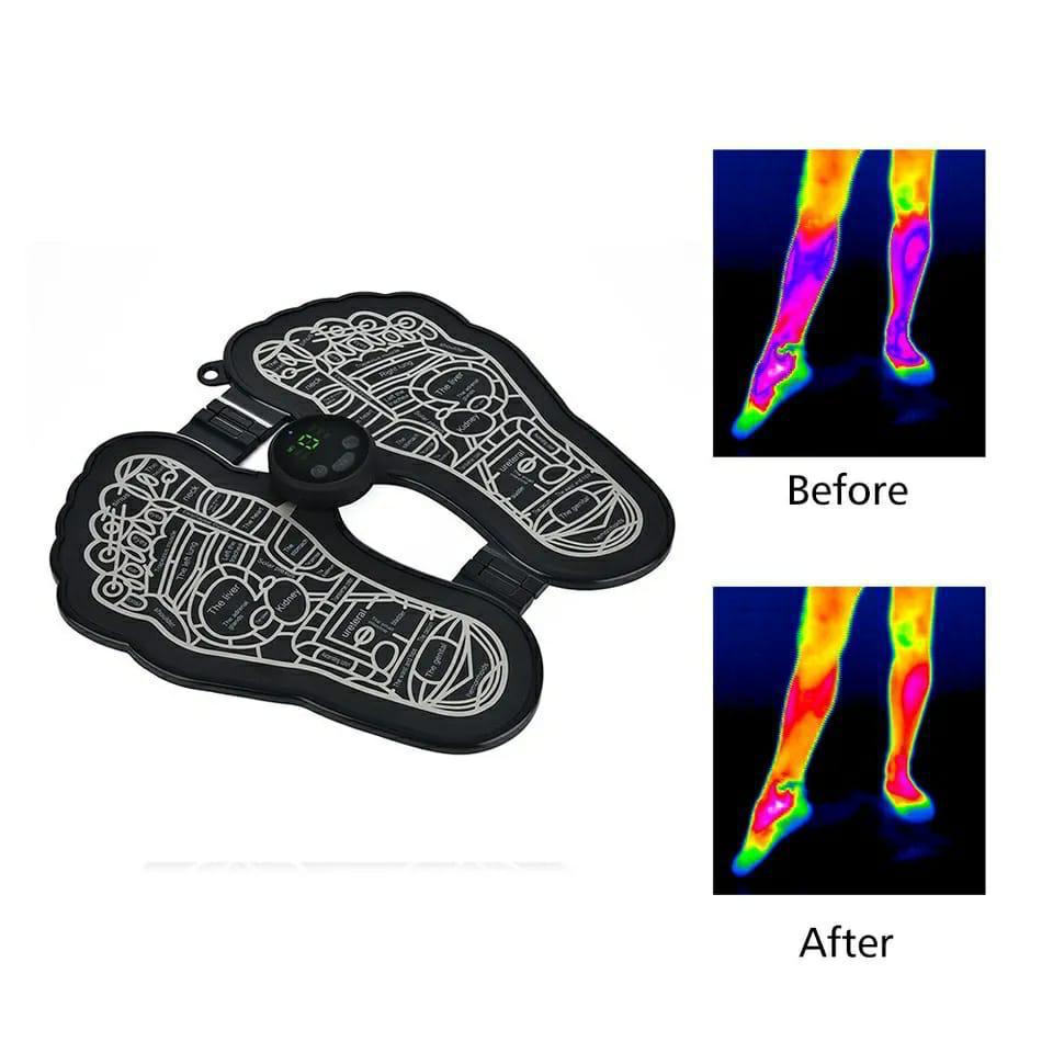 Electric Ems foot massager